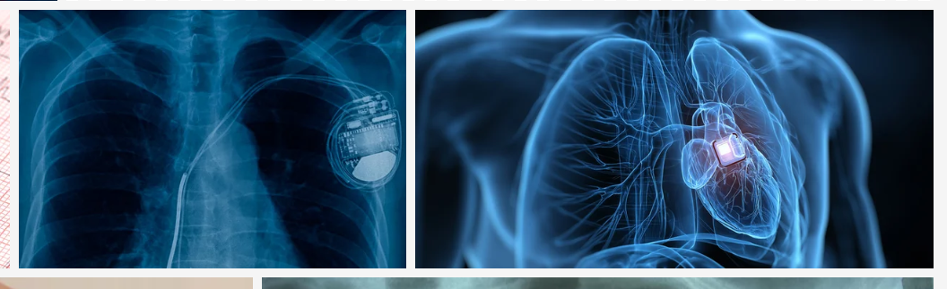 Best Cardiologist Near Me Ghatkopar Best Cardiologist Near Me Ghatkopar