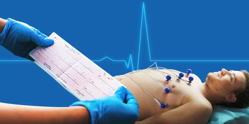 ECG